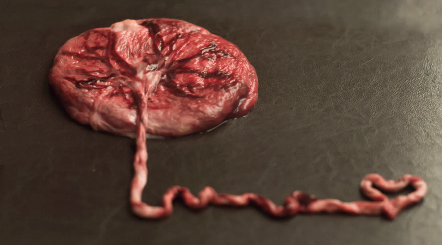 como sale la placenta